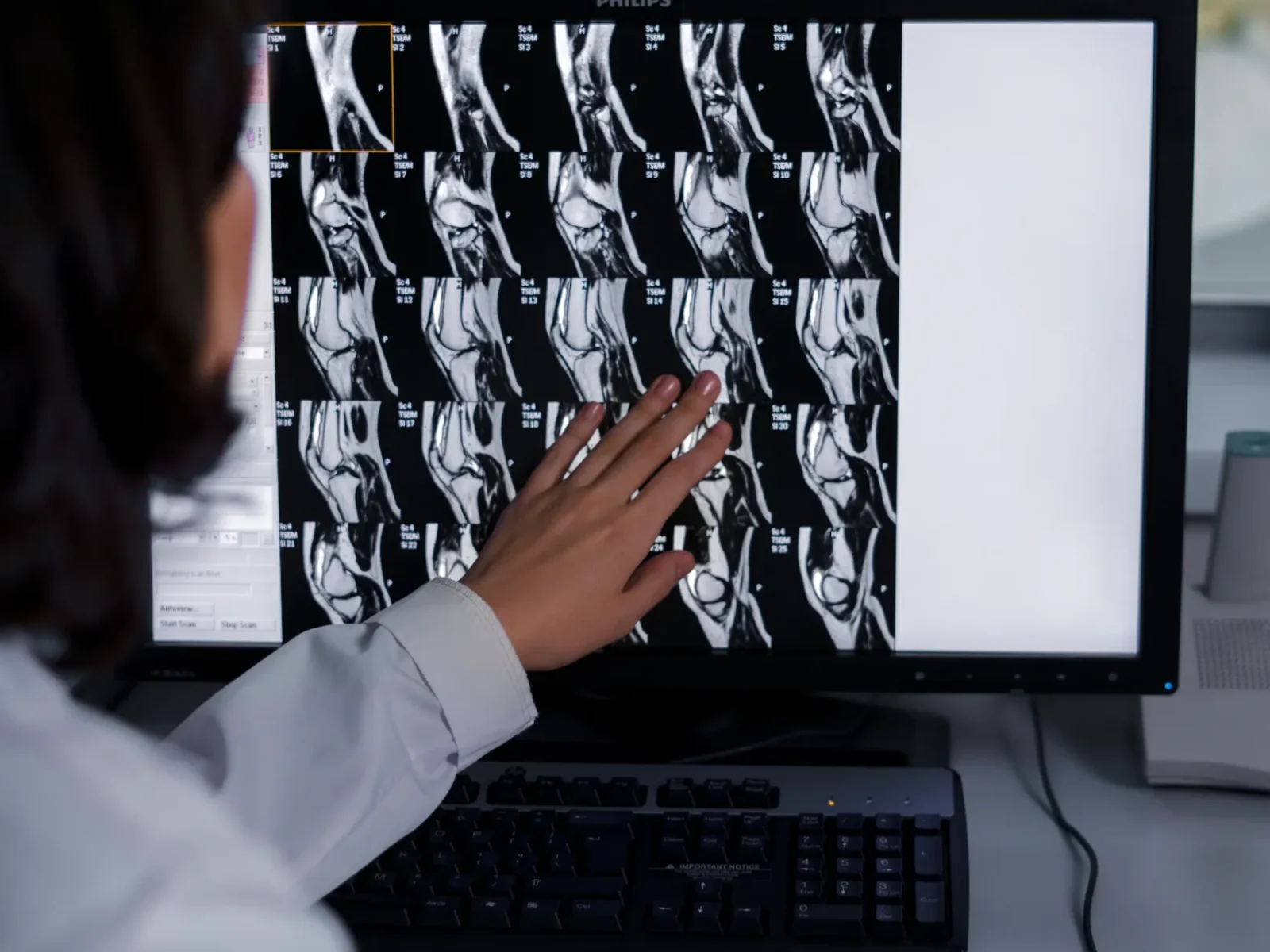 doctor-looking-ct-scan (1)